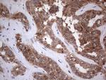 PIK3CA Antibody in Immunohistochemistry (Paraffin) (IHC (P))