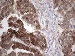 PIK3CA Antibody in Immunohistochemistry (Paraffin) (IHC (P))