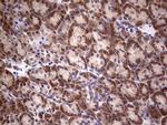 PIK3CA Antibody in Immunohistochemistry (Paraffin) (IHC (P))