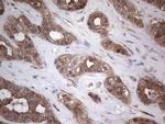 PIK3CA Antibody in Immunohistochemistry (Paraffin) (IHC (P))