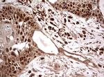 PIK3CA Antibody in Immunohistochemistry (Paraffin) (IHC (P))