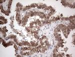 PIK3CA Antibody in Immunohistochemistry (Paraffin) (IHC (P))