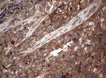 PIK3CA Antibody in Immunohistochemistry (Paraffin) (IHC (P))