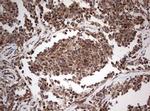 PIK3CA Antibody in Immunohistochemistry (Paraffin) (IHC (P))