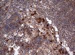 PIK3CA Antibody in Immunohistochemistry (Paraffin) (IHC (P))