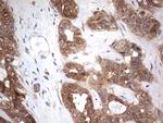 PIK3CA Antibody in Immunohistochemistry (Paraffin) (IHC (P))