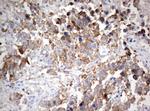 PIK3CA Antibody in Immunohistochemistry (Paraffin) (IHC (P))