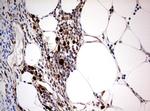 PIK3CA Antibody in Immunohistochemistry (Paraffin) (IHC (P))