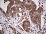 PIK3CA Antibody in Immunohistochemistry (Paraffin) (IHC (P))