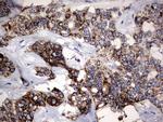 PIK3CD Antibody in Immunohistochemistry (Paraffin) (IHC (P))