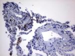 PIK3CD Antibody in Immunohistochemistry (Paraffin) (IHC (P))