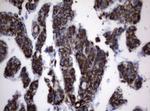 PIK3CD Antibody in Immunohistochemistry (Paraffin) (IHC (P))