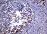 PIK3CD Antibody in Immunohistochemistry (Paraffin) (IHC (P))