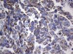 PIK3CD Antibody in Immunohistochemistry (Paraffin) (IHC (P))