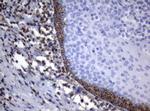 PIK3CD Antibody in Immunohistochemistry (Paraffin) (IHC (P))