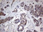 PIK3CD Antibody in Immunohistochemistry (Paraffin) (IHC (P))