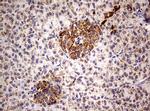 PIK3CD Antibody in Immunohistochemistry (Paraffin) (IHC (P))