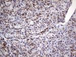 PIK3CD Antibody in Immunohistochemistry (Paraffin) (IHC (P))