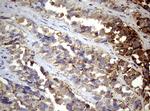 PIK3CD Antibody in Immunohistochemistry (Paraffin) (IHC (P))