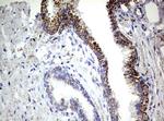 PIK3CD Antibody in Immunohistochemistry (Paraffin) (IHC (P))