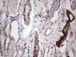 PIK3CD Antibody in Immunohistochemistry (Paraffin) (IHC (P))