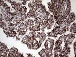 PIK3CD Antibody in Immunohistochemistry (Paraffin) (IHC (P))