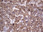 PIK3CD Antibody in Immunohistochemistry (Paraffin) (IHC (P))