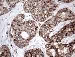 PIK3CD Antibody in Immunohistochemistry (Paraffin) (IHC (P))