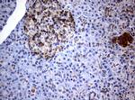 PIK3CD Antibody in Immunohistochemistry (Paraffin) (IHC (P))