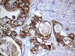 PIK3CD Antibody in Immunohistochemistry (Paraffin) (IHC (P))