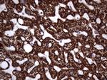 PIK3CD Antibody in Immunohistochemistry (Paraffin) (IHC (P))