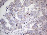 PIK3CD Antibody in Immunohistochemistry (Paraffin) (IHC (P))