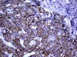 PIK3CD Antibody in Immunohistochemistry (Paraffin) (IHC (P))