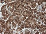 PIK3CG Antibody in Immunohistochemistry (Paraffin) (IHC (P))