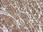 PIK3CG Antibody in Immunohistochemistry (Paraffin) (IHC (P))