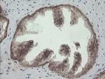 PIK3CG Antibody in Immunohistochemistry (Paraffin) (IHC (P))