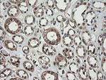 PIK3CG Antibody in Immunohistochemistry (Paraffin) (IHC (P))