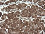 PIK3CG Antibody in Immunohistochemistry (Paraffin) (IHC (P))