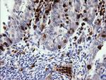 PIK3CG Antibody in Immunohistochemistry (Paraffin) (IHC (P))