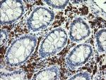 PIK3CG Antibody in Immunohistochemistry (Paraffin) (IHC (P))