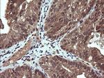 PIK3CG Antibody in Immunohistochemistry (Paraffin) (IHC (P))