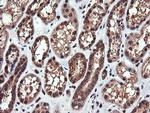 PIK3CG Antibody in Immunohistochemistry (Paraffin) (IHC (P))