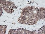 PIK3CG Antibody in Immunohistochemistry (Paraffin) (IHC (P))