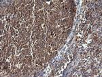 PIK3CG Antibody in Immunohistochemistry (Paraffin) (IHC (P))