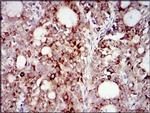 PI3K p85 alpha Antibody in Immunohistochemistry (Paraffin) (IHC (P))