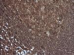 PIK3R5 Antibody in Immunohistochemistry (Paraffin) (IHC (P))