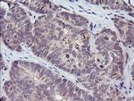 PIK3R5 Antibody in Immunohistochemistry (Paraffin) (IHC (P))