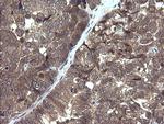 PIK3R5 Antibody in Immunohistochemistry (Paraffin) (IHC (P))