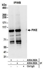 PIKE Antibody in Immunoprecipitation (IP)