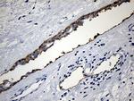 PIKFYVE Antibody in Immunohistochemistry (Paraffin) (IHC (P))